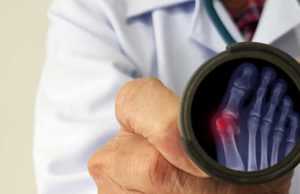 Treace Medical Concepts (TMCI): обзор деятельности компании и её акций