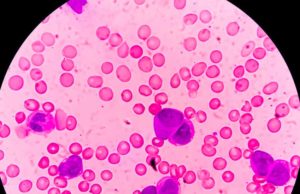 Aptose Biosciences (APTO): обзор деятельности компании и её акций