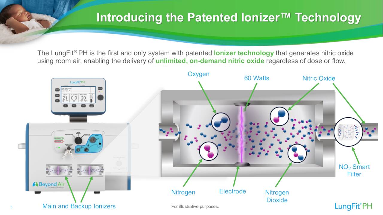 Представляем запатентованную технологию Ionizer™