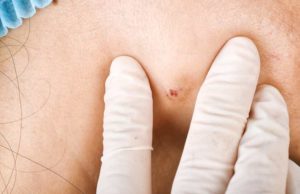 Trevi Therapeutics (TRVI): обзор деятельности компании и её акций